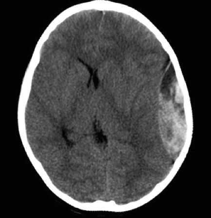 Brain scan